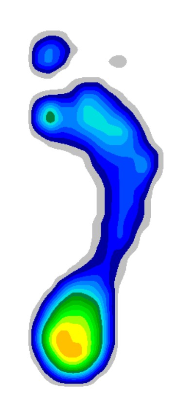 Standanalyse rechter Fuß
